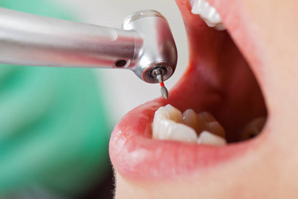 Best Tooth Pain Emergency Relief  in Pana, IL